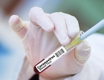 COVID-19 : une lueur d'espoir dans la lutte contre le virus ?